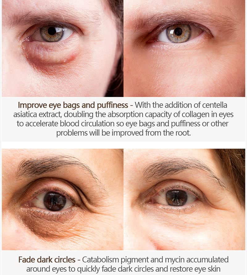 Reducere rapidă Cremă de ochi Vitamina C Brighting Eye Cream pentru riduri Sacii de ochi Cercuri întunecate și Pufuzie, ser